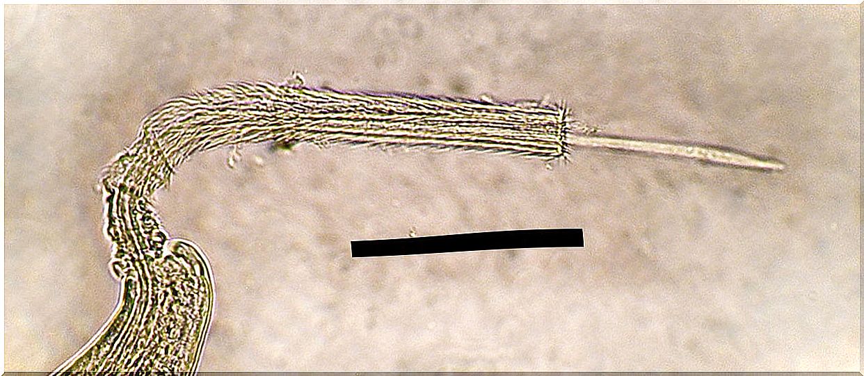 Nematodo Capilaria